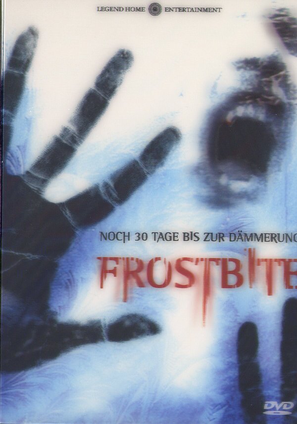 Frostbite