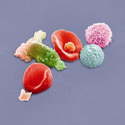 Peter Gabriel - New Blood - Live in London (&Eacute;dition Deluxe, Blu-ray + DVD + 2 CD)