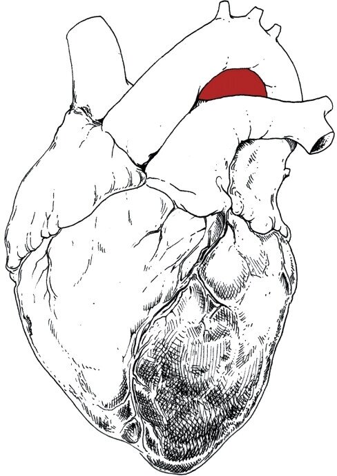 Swans - The Beggar Gatefold, LP